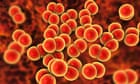 Gonorrhoea getting more drug-resistant and ‘may become untreatable’