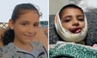 Mazyouna’s face was ‘ripped off’ when a rocket hit her home. Israel has refused to allow her evacuation