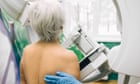 Cancer screening take ups not back to pre-pandemic levels, charity warns